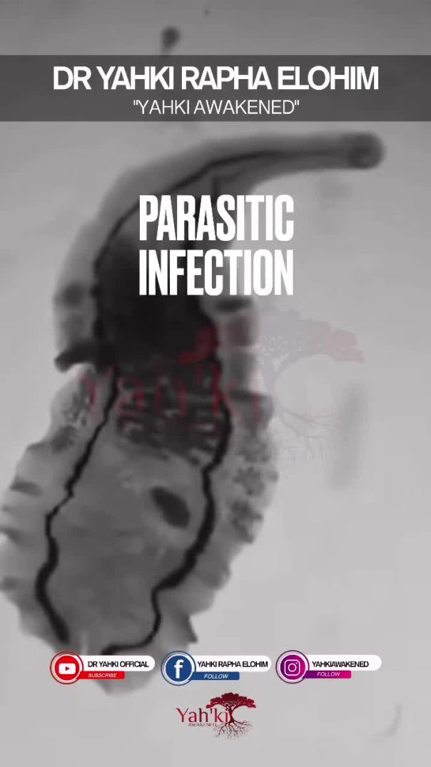 🩸 FAMILY, THEY LIED ABOUT IRON‼️